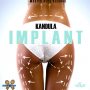 KANDULA - IMPLANT - SINGLE #ITUNES 3/17/17 @kandulamusic